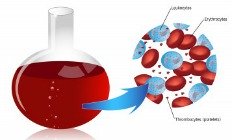 Blood cells: balancing white blood cells of the immune system to heal vertigo